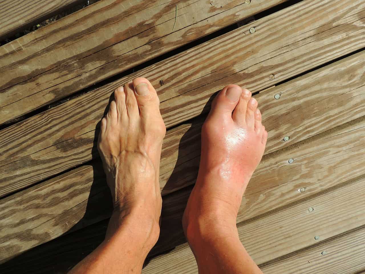 Cosa fare in caso di dolore alla caviglia e quali possono essere le cause